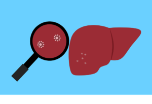 Free Liver Bacteria vector and picture